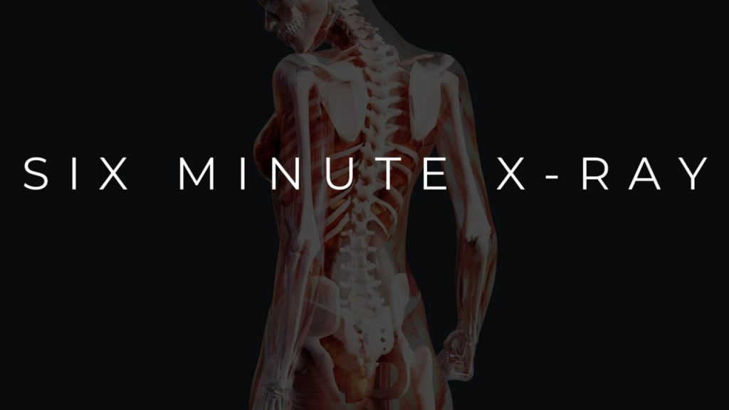 6-Minute X-Ray – Chase Hughes